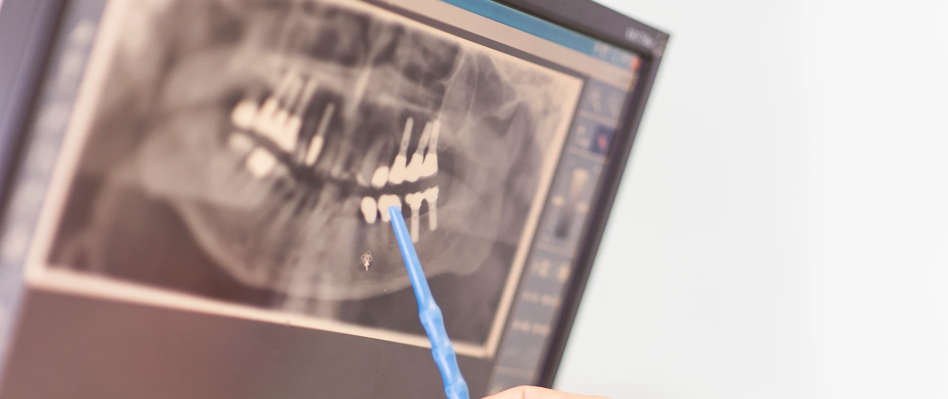Aufnahme eines digitalen Röntgenbilds