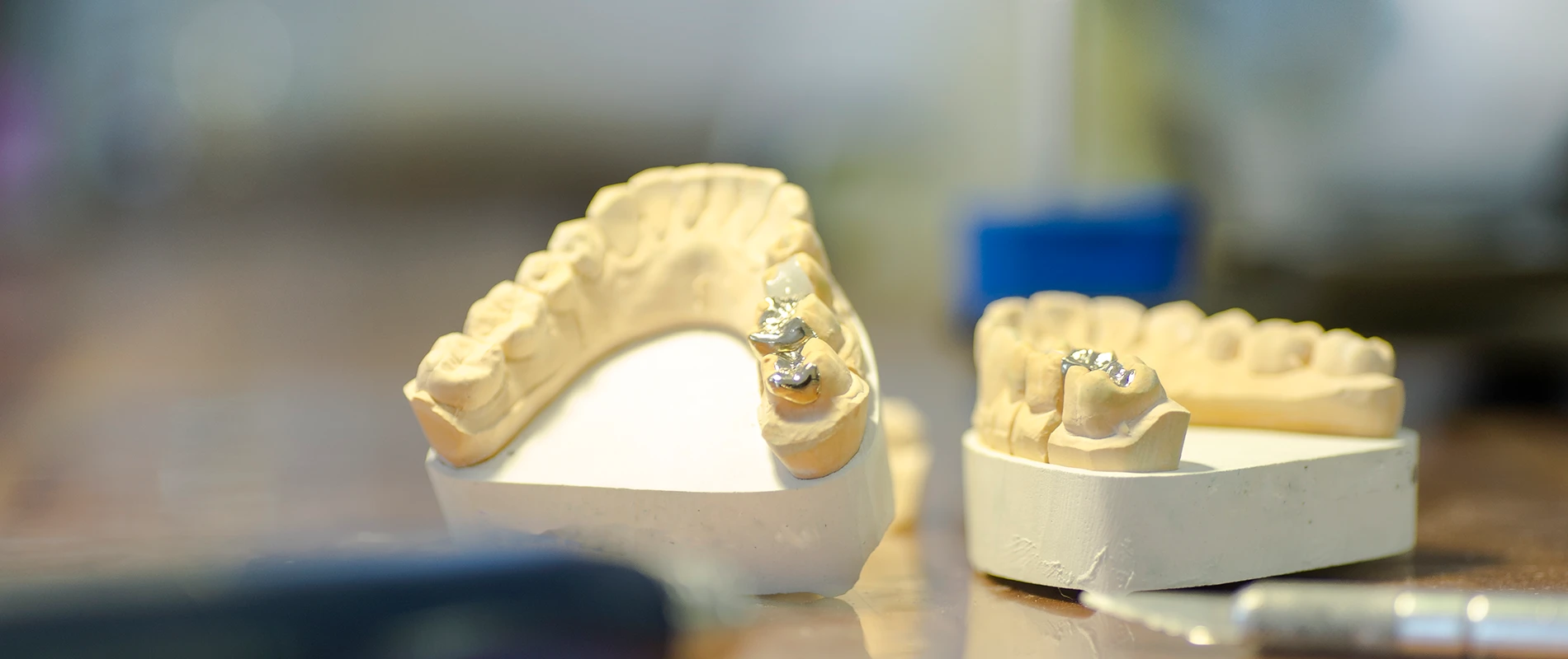 Nahaufnahme von Ober- und Unterkiefer 3D-Zahnmodellen